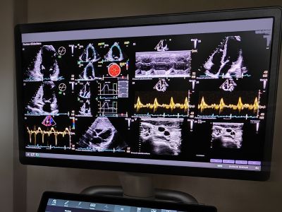 Echokardipgraphie auf dem GE Vivid Pioneer im Medicum Lüneburg